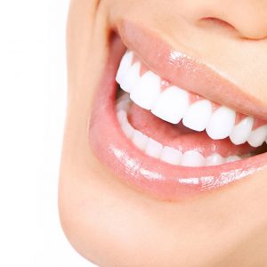 Prep your Perfect Smile